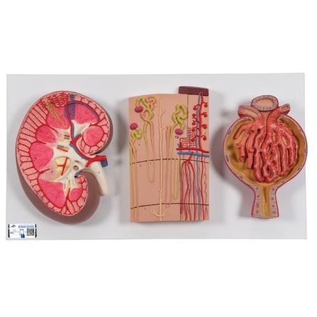 Kidney Sect., Nephrons, Blood - W/ 3B Smart Anatomy